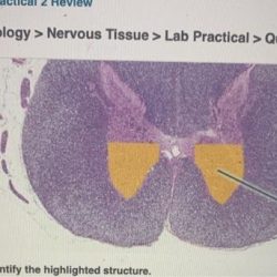 Histology of nervous tissue exercise 15