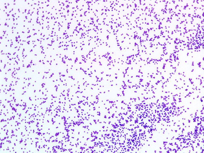 A stained specimen of bacteria to study morphology