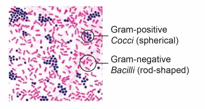 A stained specimen of bacteria to study morphology